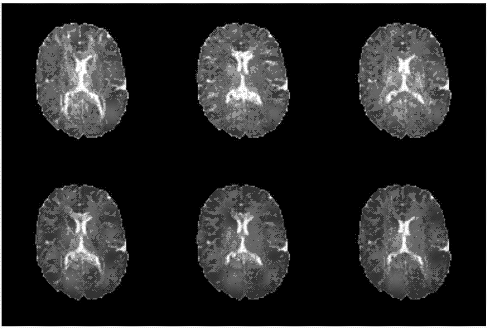 Parameter error estimation method and device of magnetic resonance diffusion tensor imaging