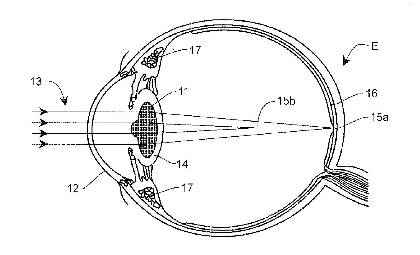 Lens providing extended depth of focus and method relating to same