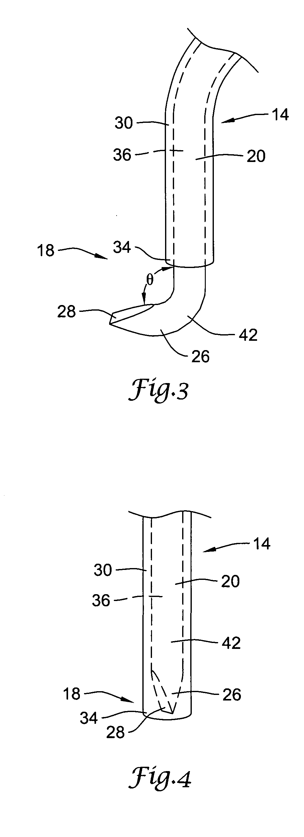Retrievable blood clot filter with retractable anchoring members