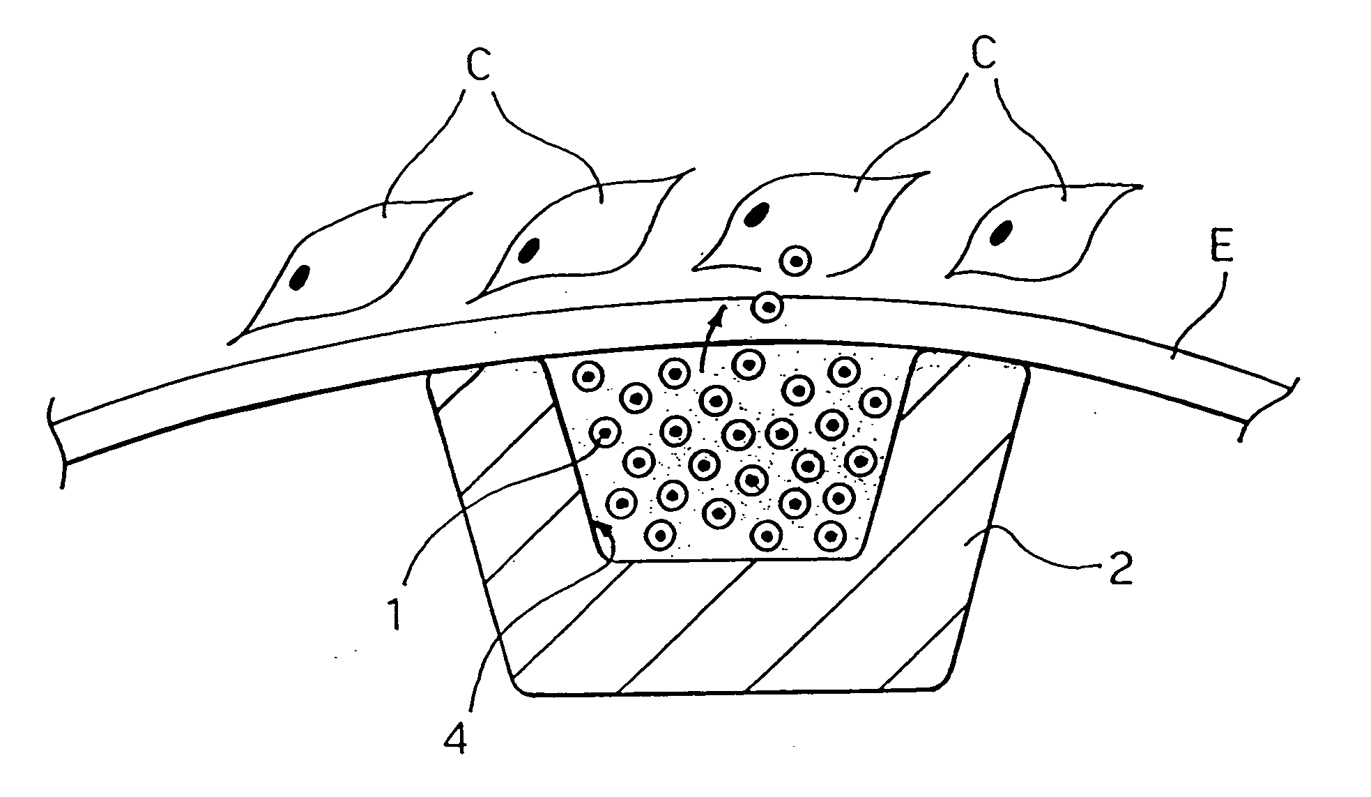Carrier and kit for intraluminal delivery of active principles or agents