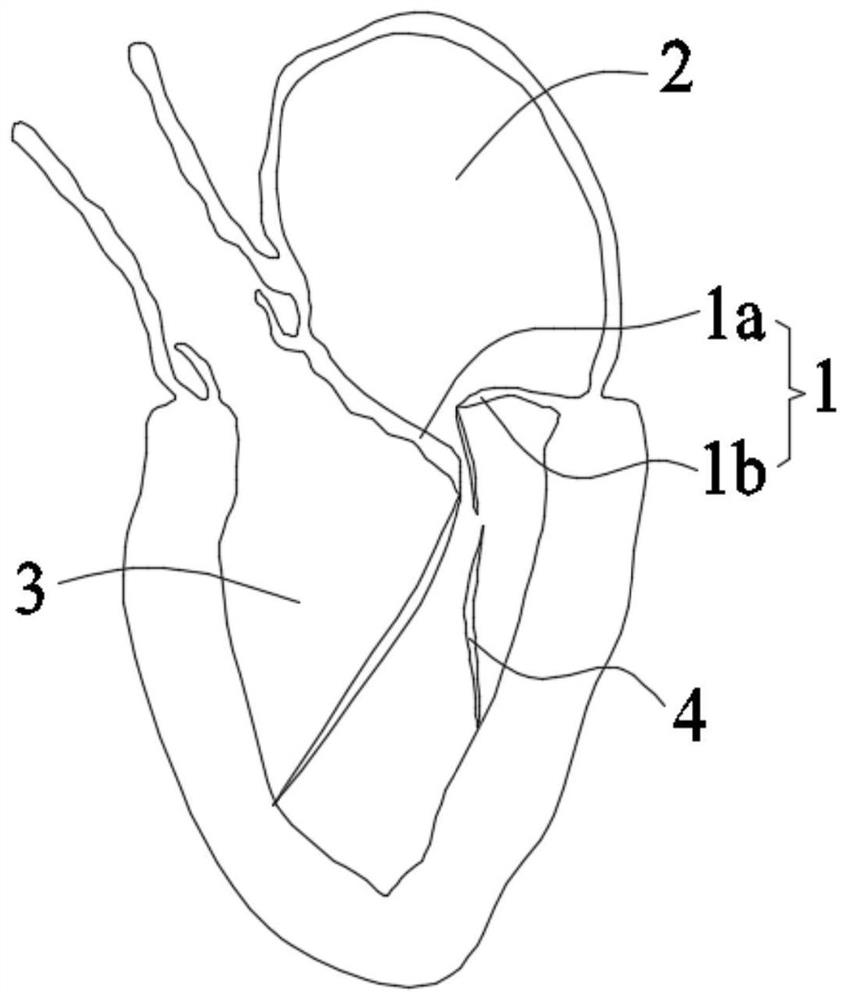 Adjustable valve clamping system