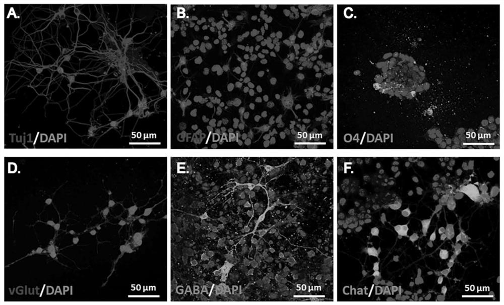 Preparation method and application of personalized induced neural stem cell exosome