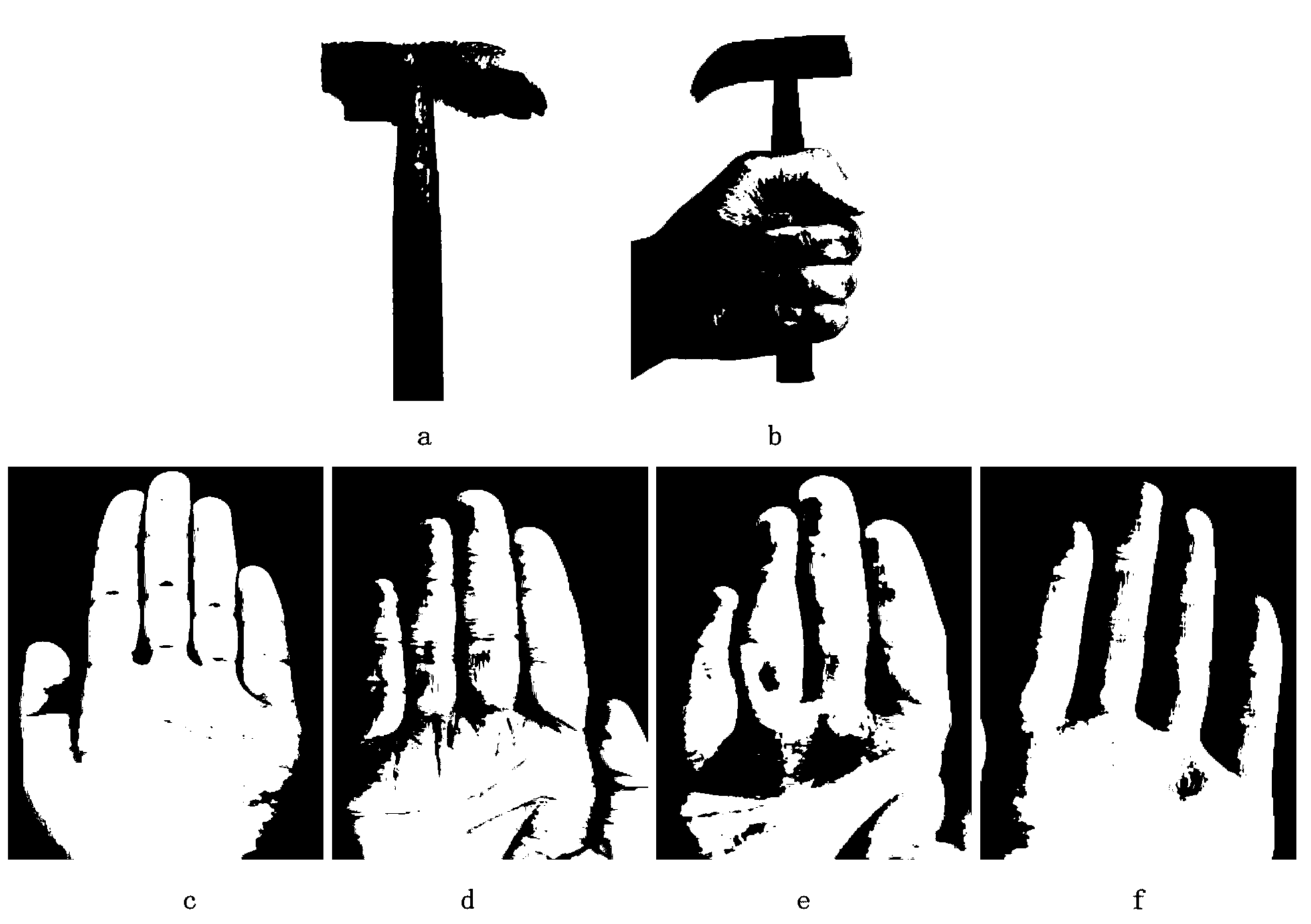 Ethanol solution method for quickly displaying metal reserved marks on skin surfaces of human bodies