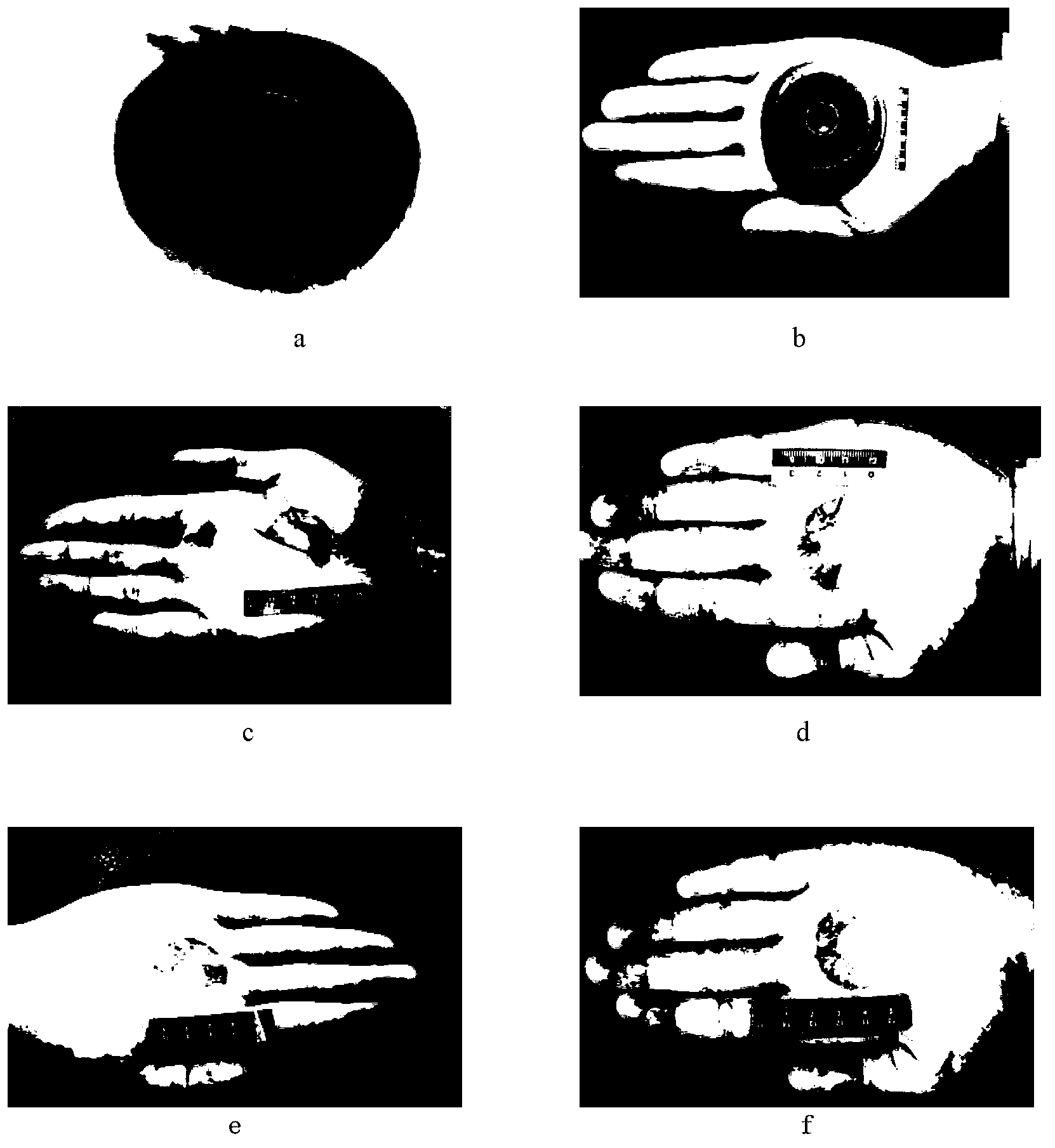 Ethanol solution method for quickly displaying metal reserved marks on skin surfaces of human bodies