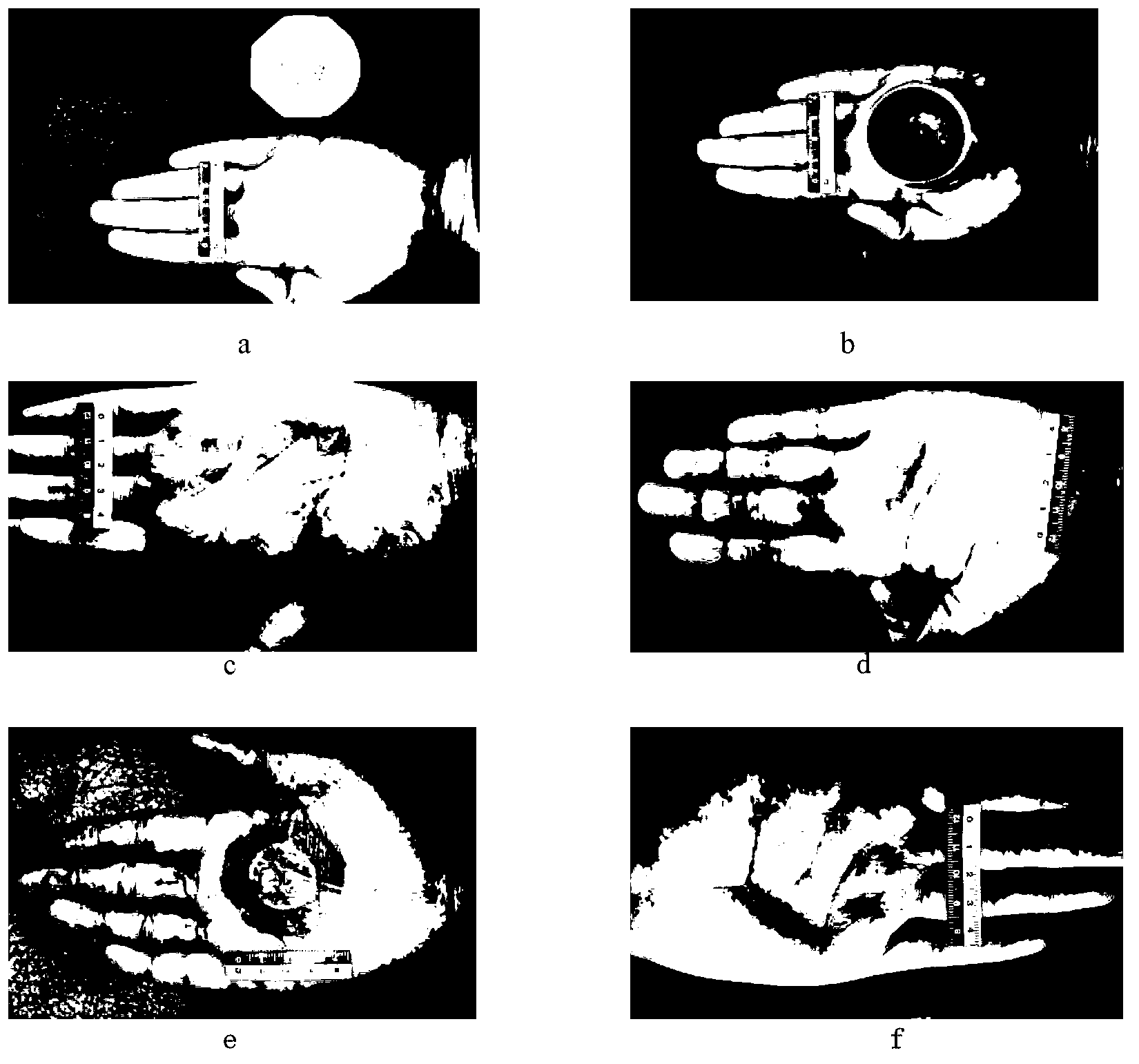 Ethanol solution method for quickly displaying metal reserved marks on skin surfaces of human bodies