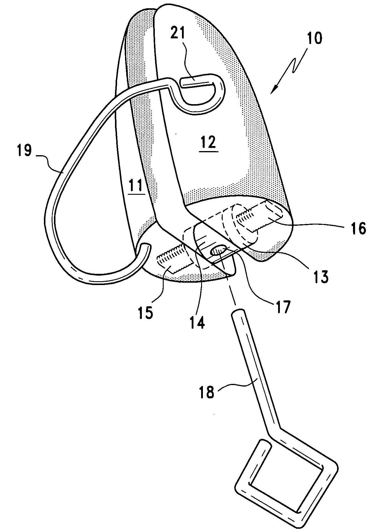 Orthonostric device and method of forming the same