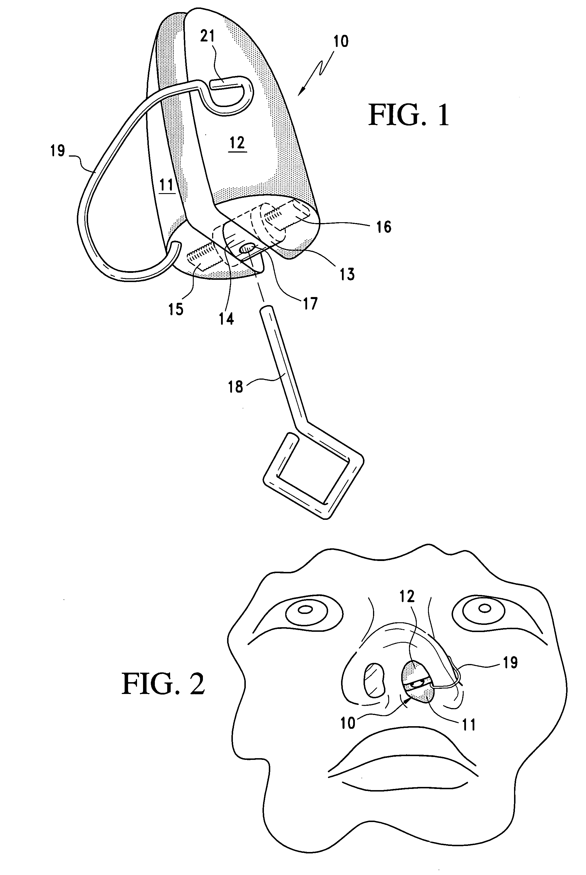 Orthonostric device and method of forming the same