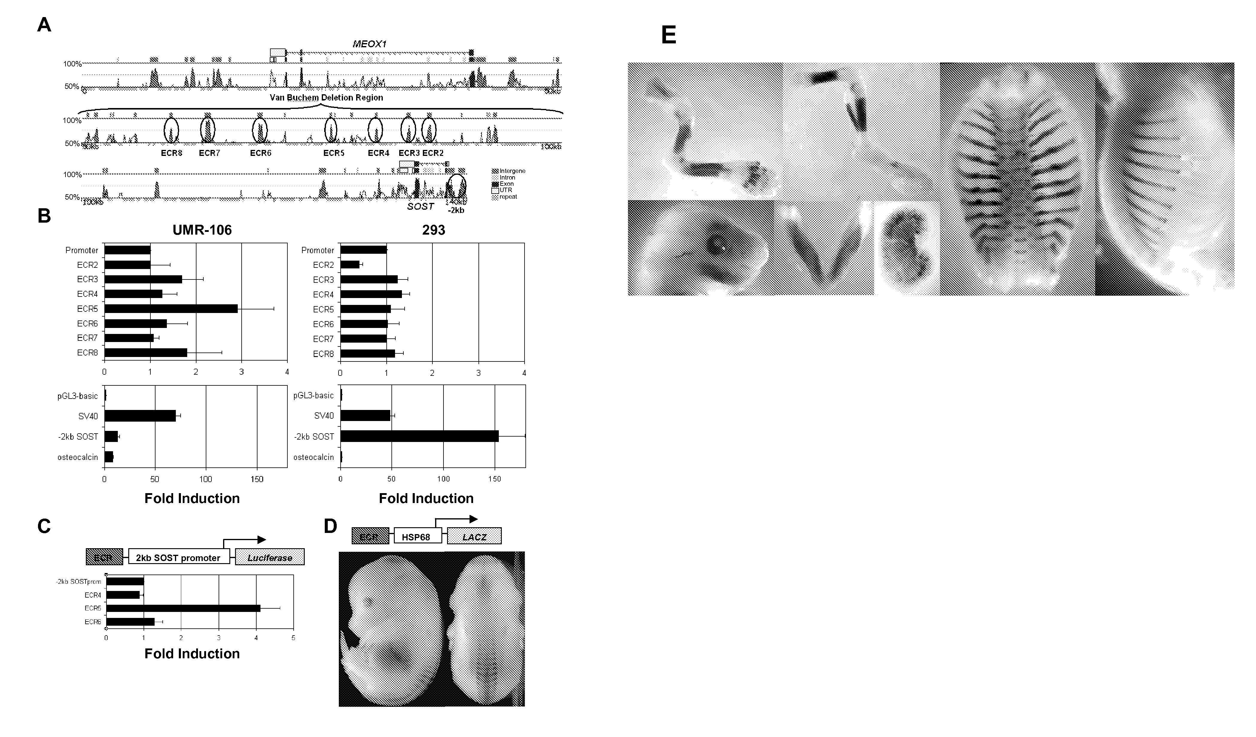 Compositions and methods for altering bone density and bone patterning