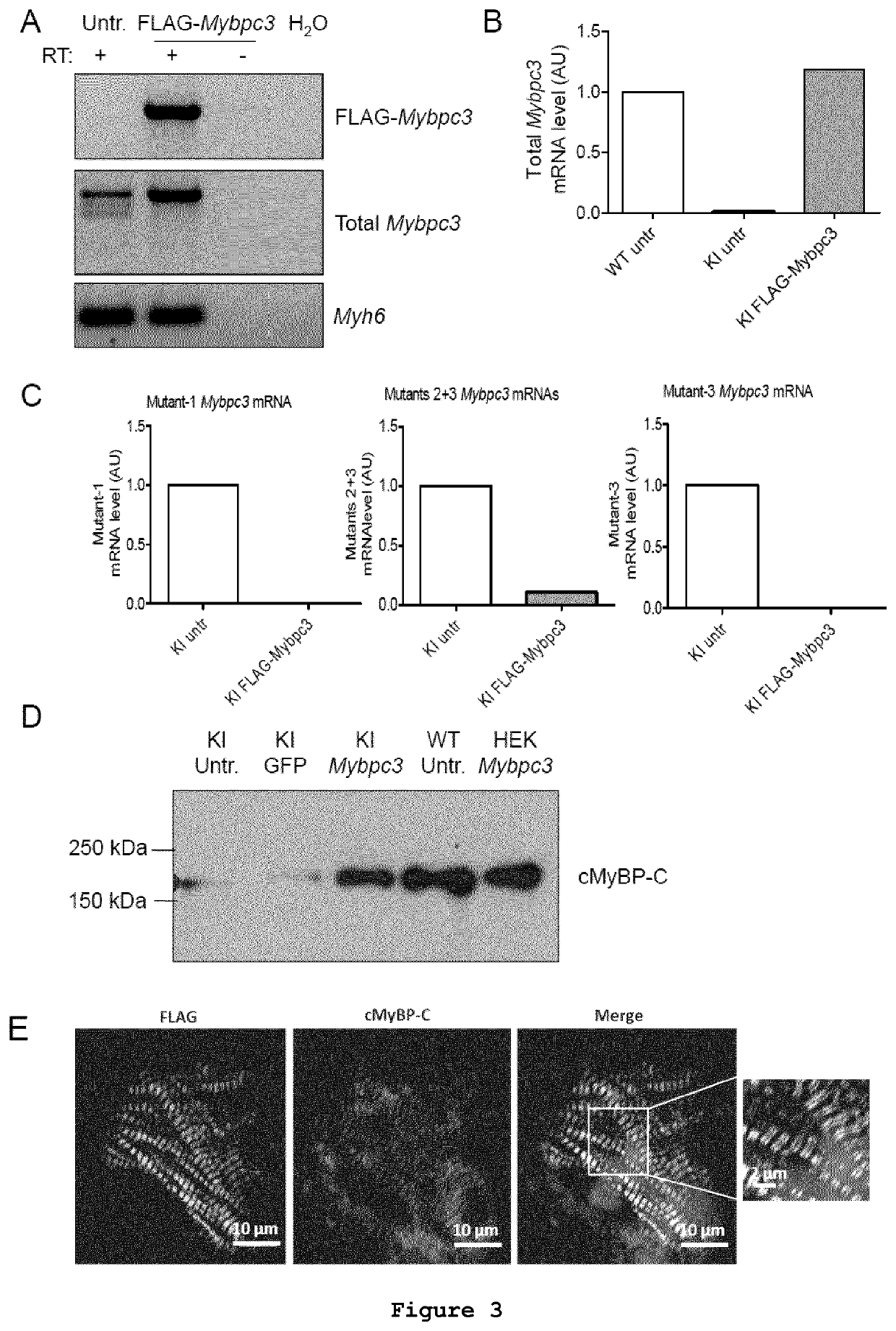 Gene-therapy vectors for treating cardiomyopathy