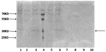 Human Procalcitonin Colloidal Gold Quantitative Detection Card