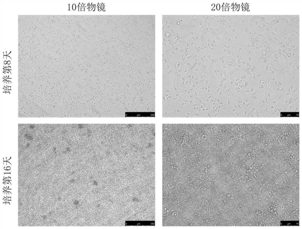 Application of CD137 antibody in preparation of drugs for promoting NK cells to express CD16 molecules