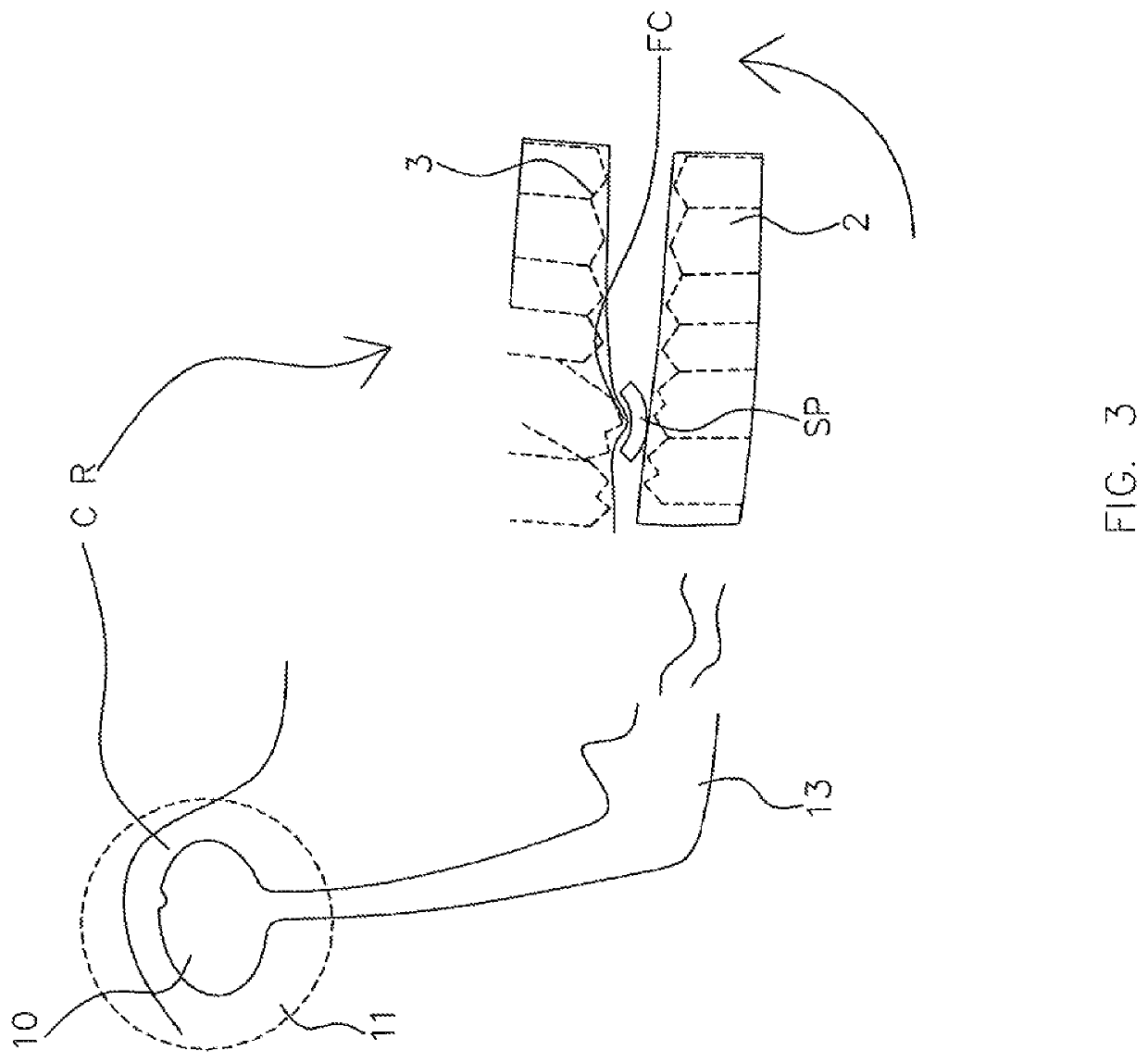 Oral appliances, packages, systems, and components