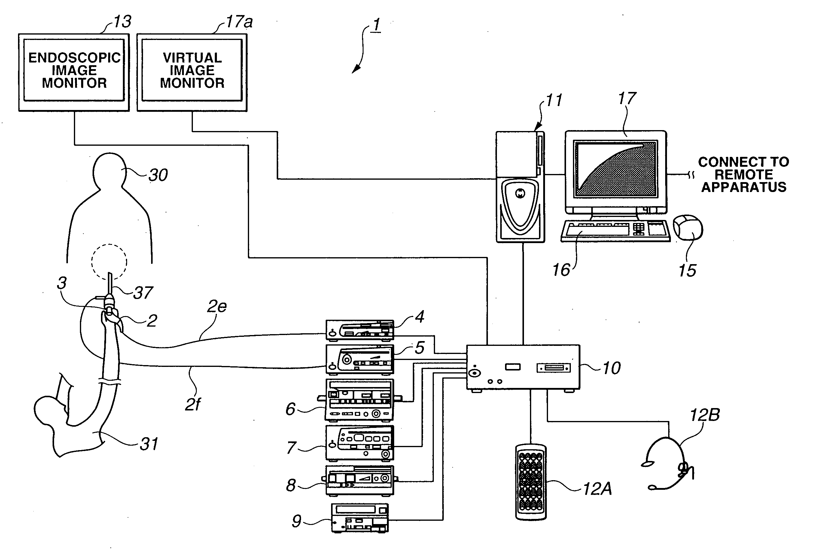 Medical procedure support system and method