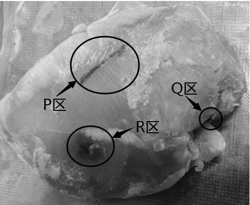 Application of Mitoxantrone Hydrochloride Injection for Futashu Tracing as a Fluorescent Tracer and a Fluorescent Camera Device for It