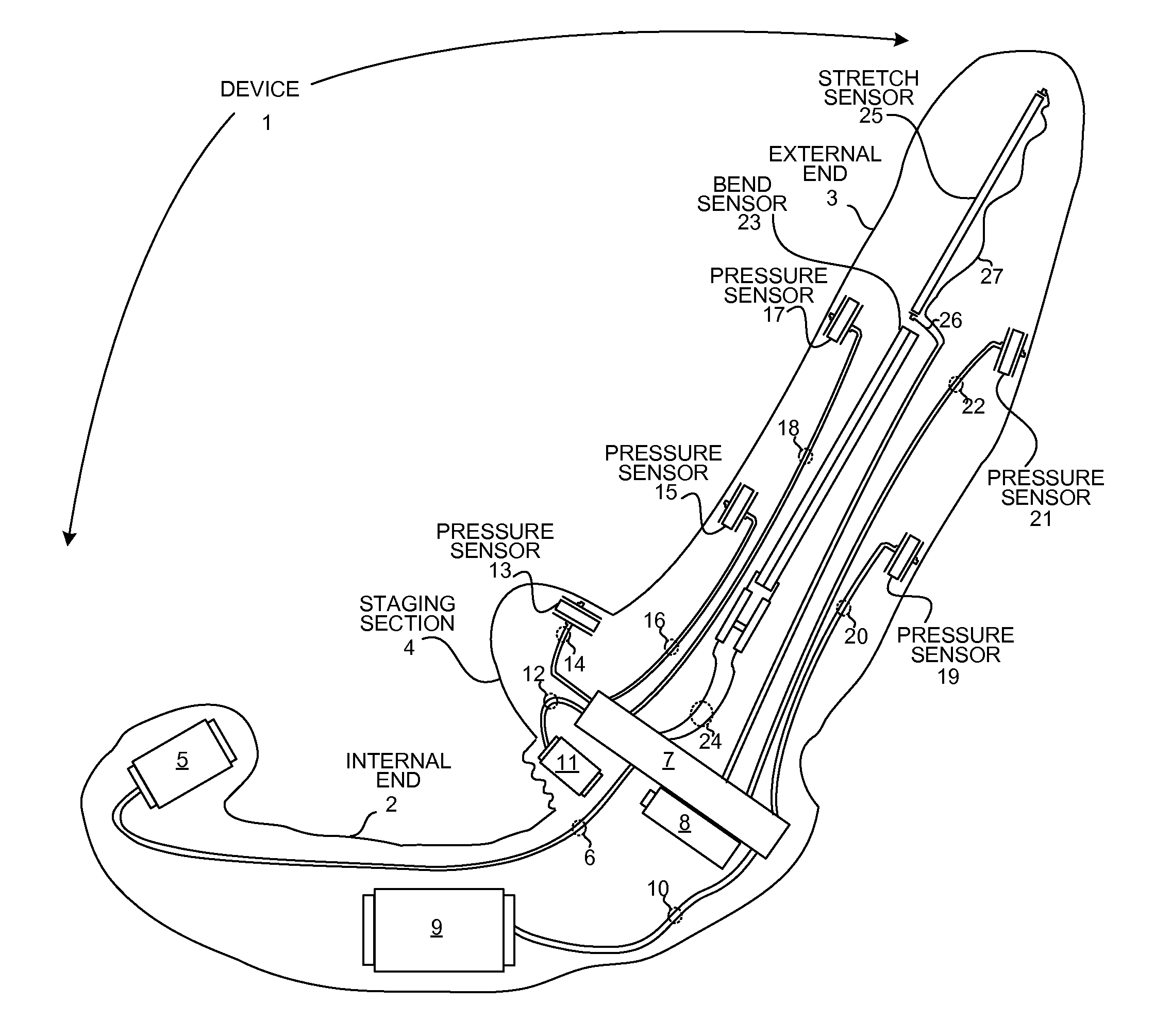 Cybernetic vibrator device with sensors for in-situ gesture controls
