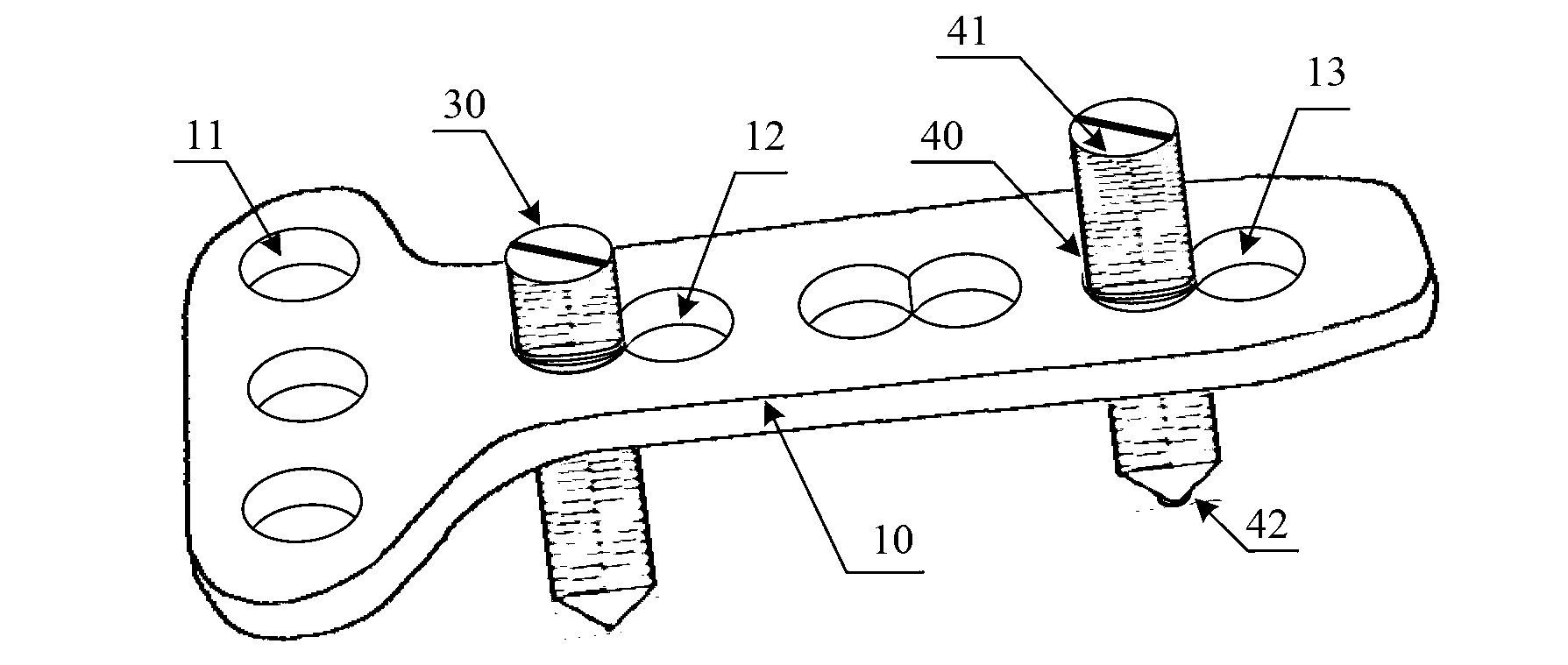 Distal radius fracture fastener with angle correcting structure