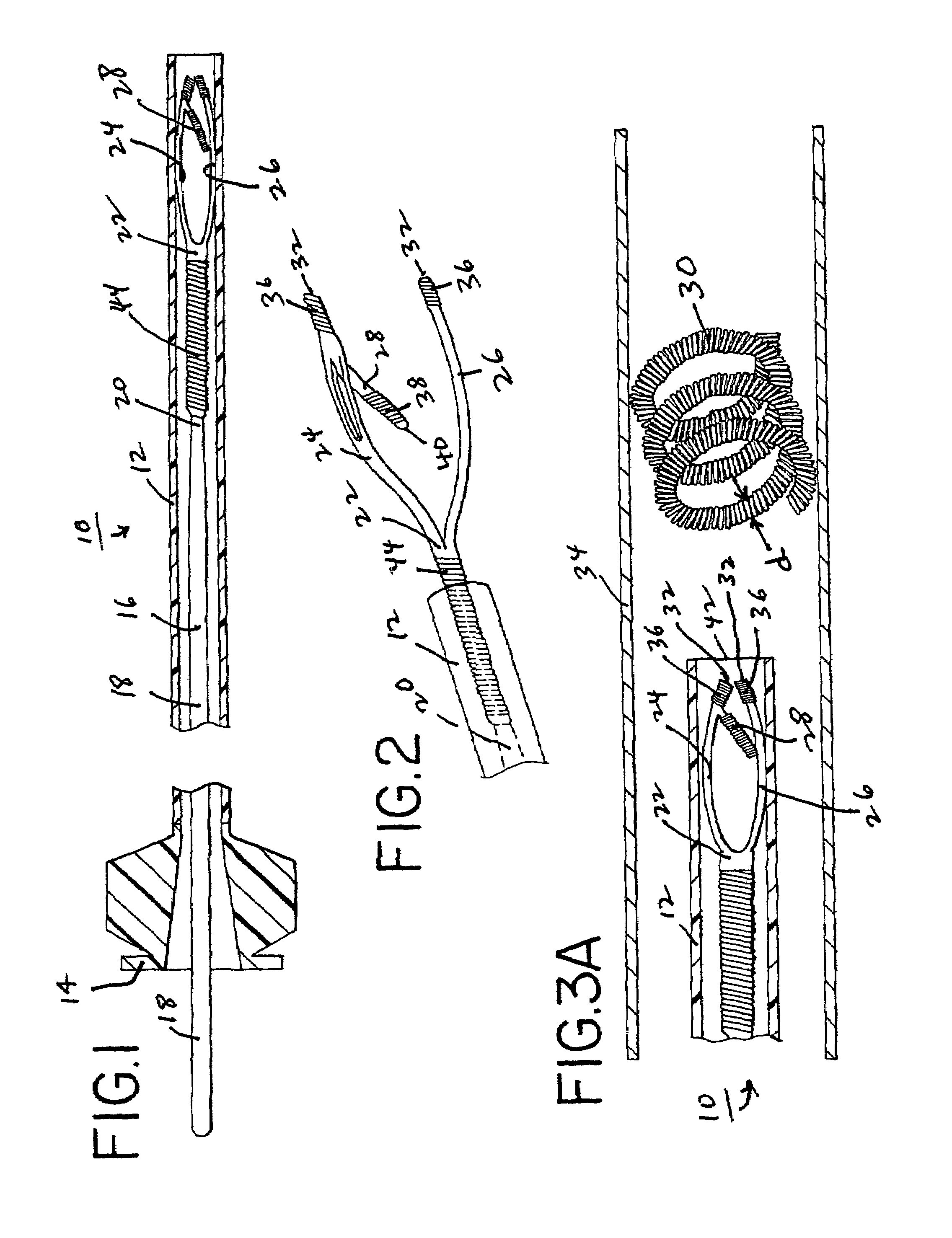 Method and device for retrieving embolic coils