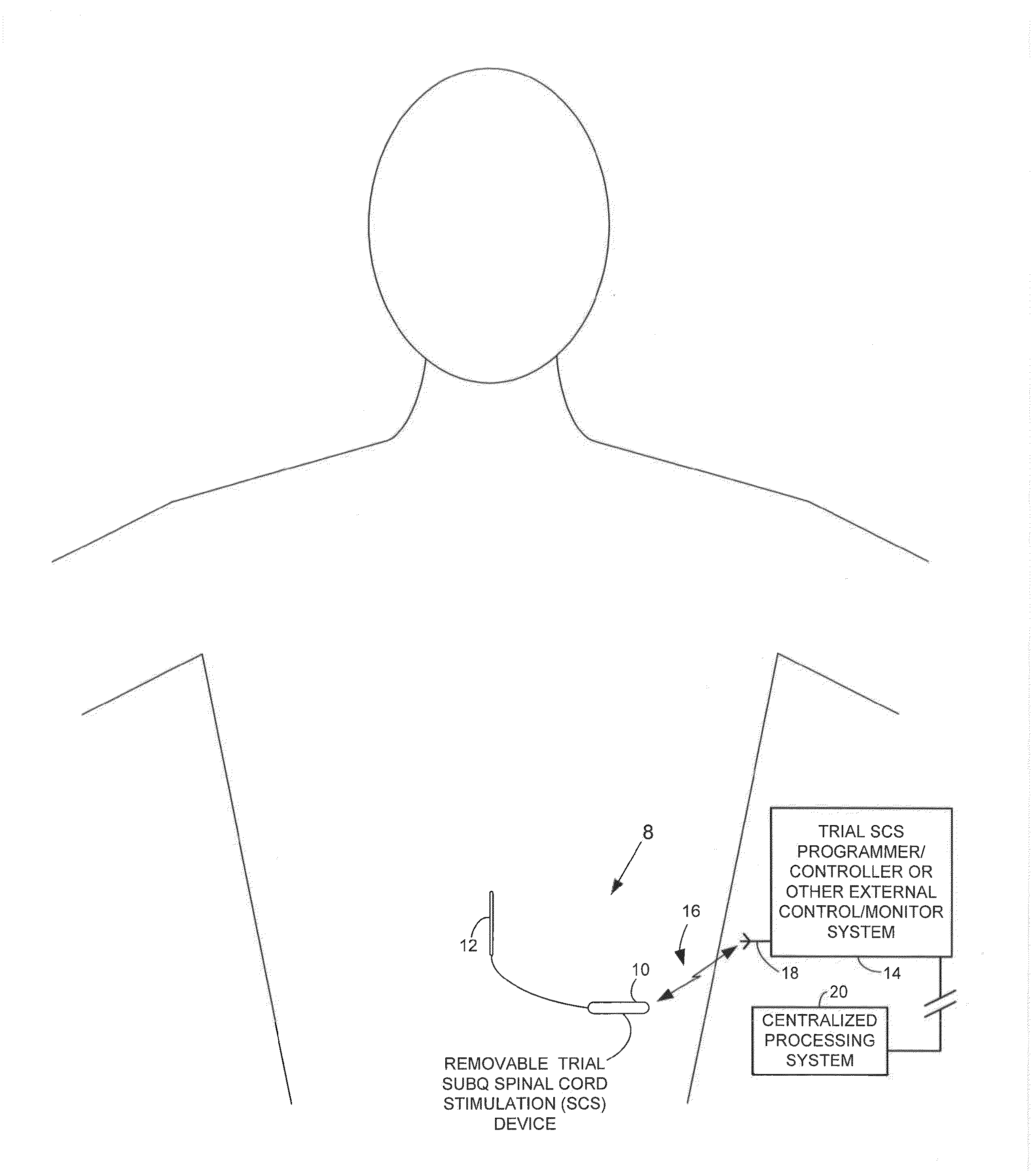 Fully implantable trial neurostimulation system configured for minimally-intrusive implant/explant