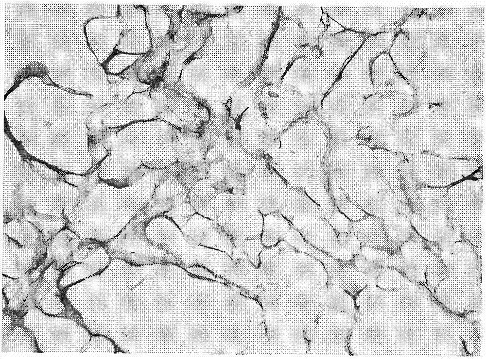 Preparation method of decellularized biological omentum and decellularized biological omentum prepared therefrom