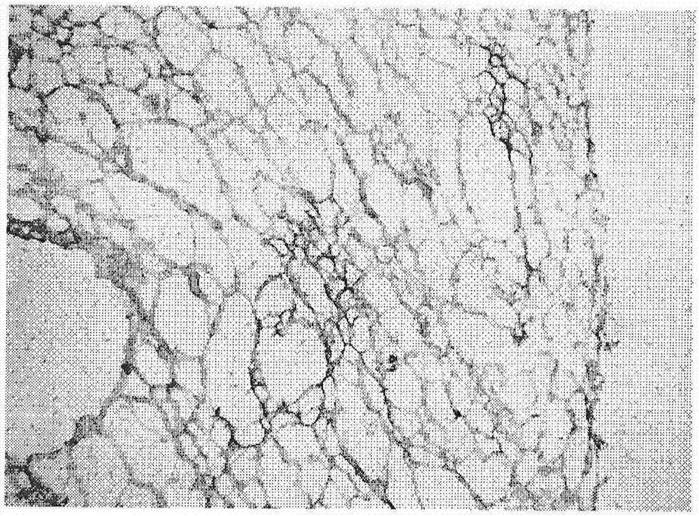 Preparation method of decellularized biological omentum and decellularized biological omentum prepared therefrom