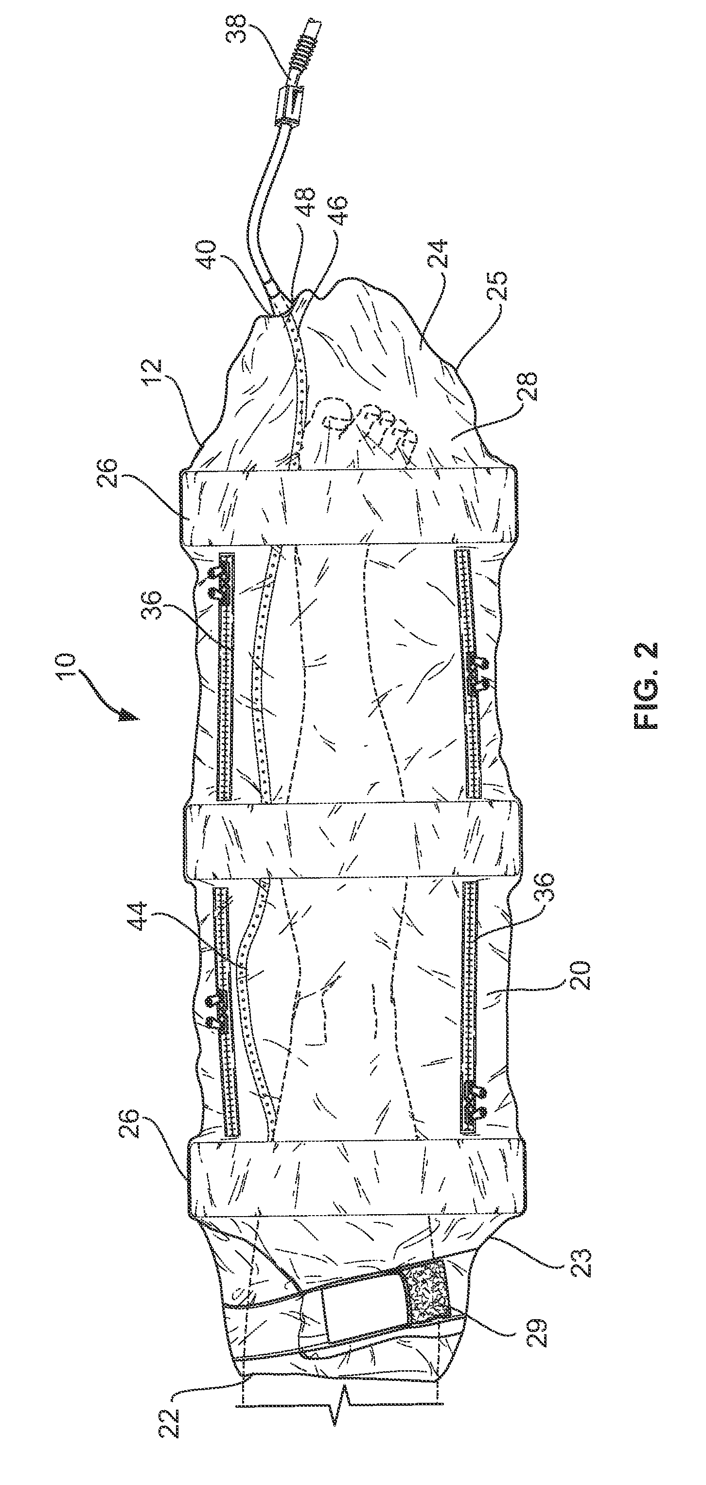 Collapsible fluid containment device with semi-rigid support members
