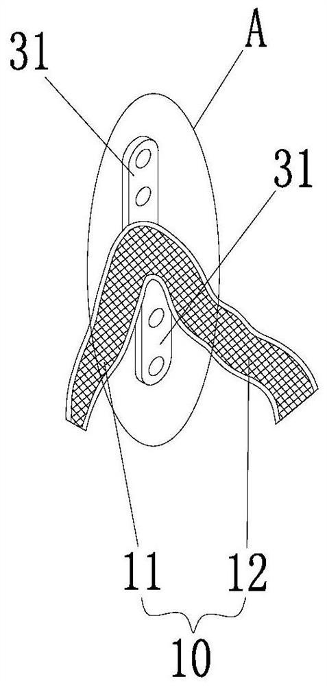 Fracture fixation structure and fracture fixation component therewith