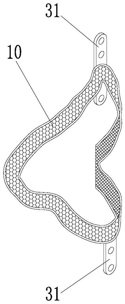 Fracture fixation structure and fracture fixation component therewith