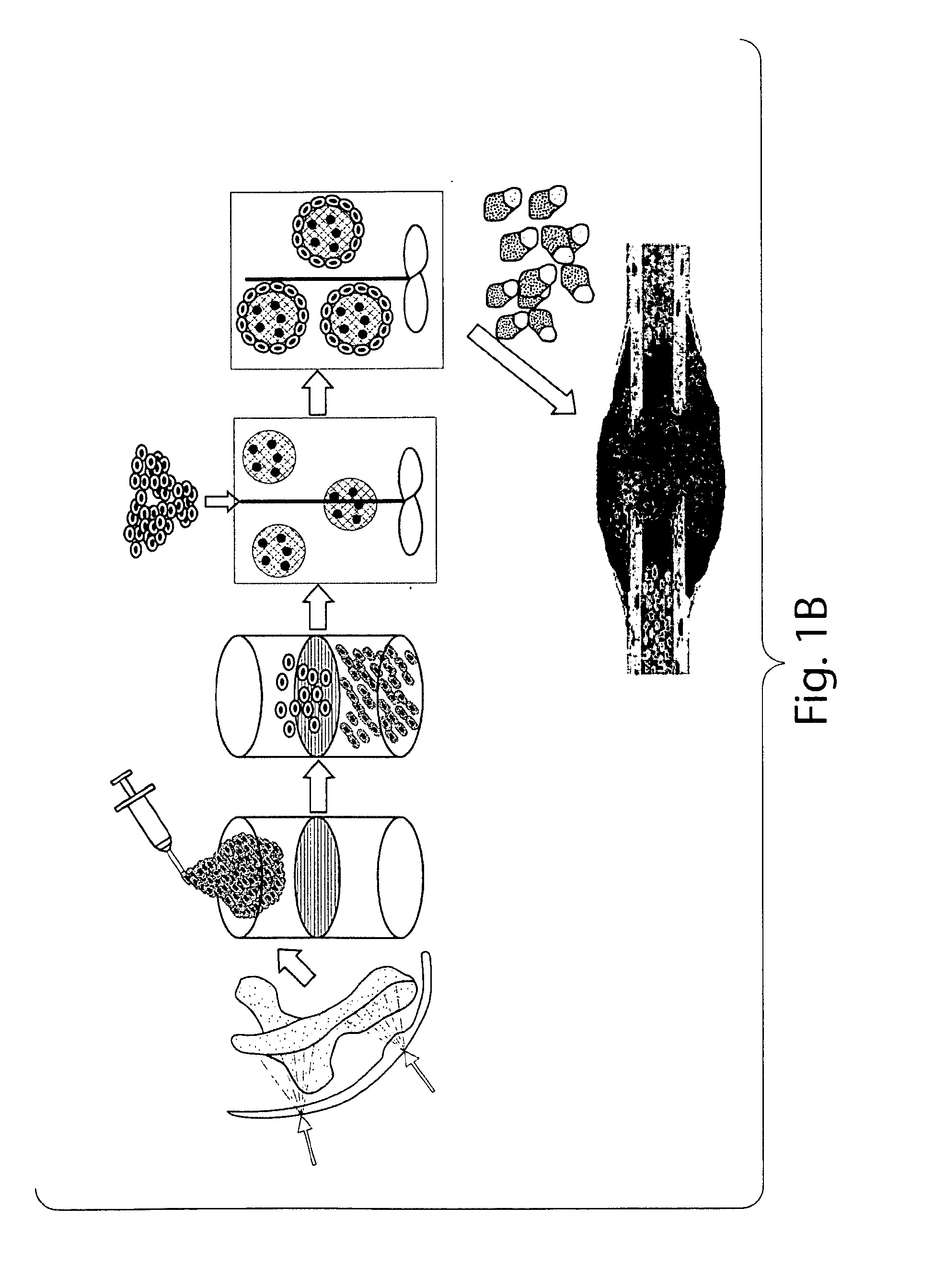 Methods and compositions relating to progenitor cells