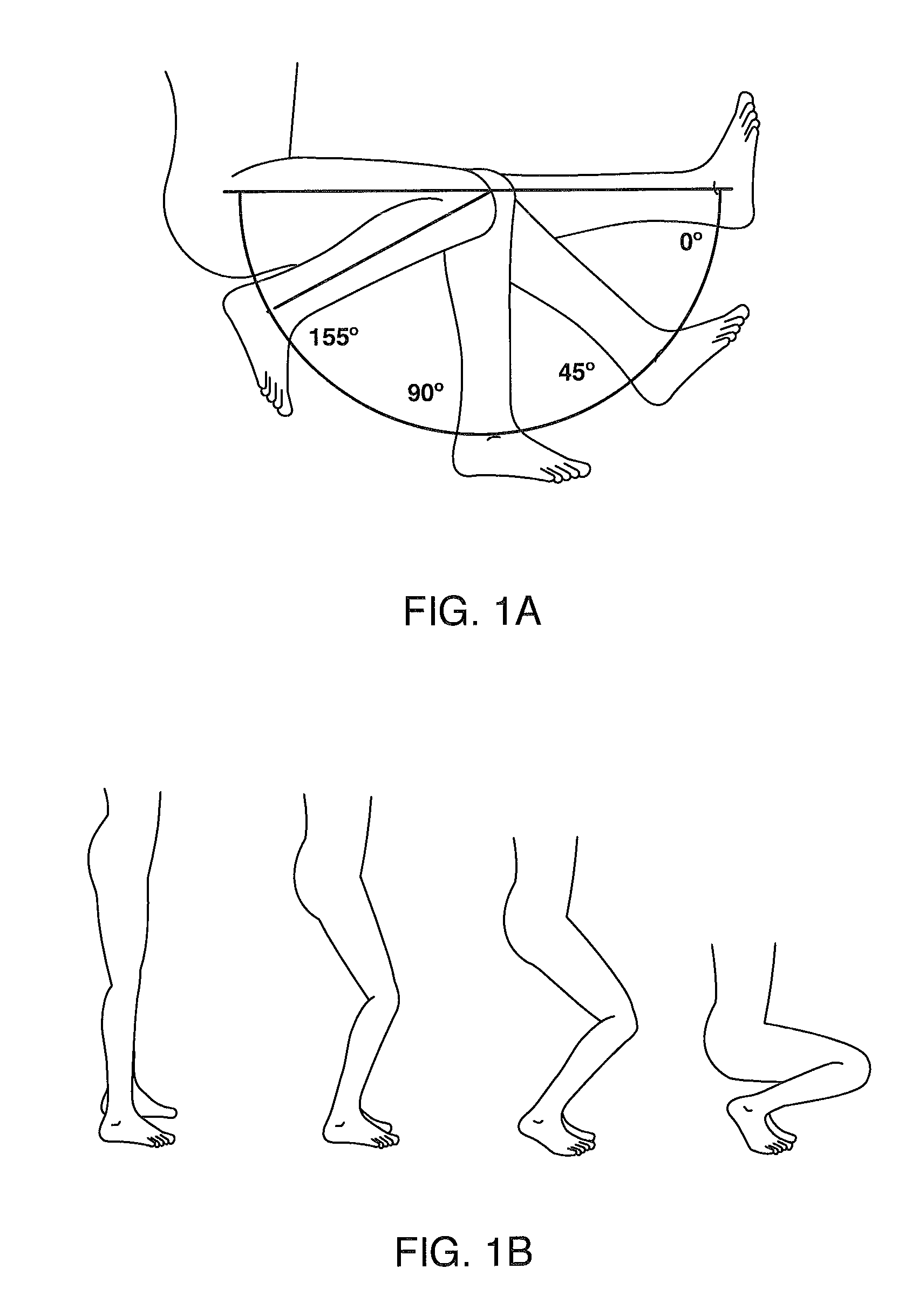 Systems and methods for providing a femoral component with a modified posterior condyle