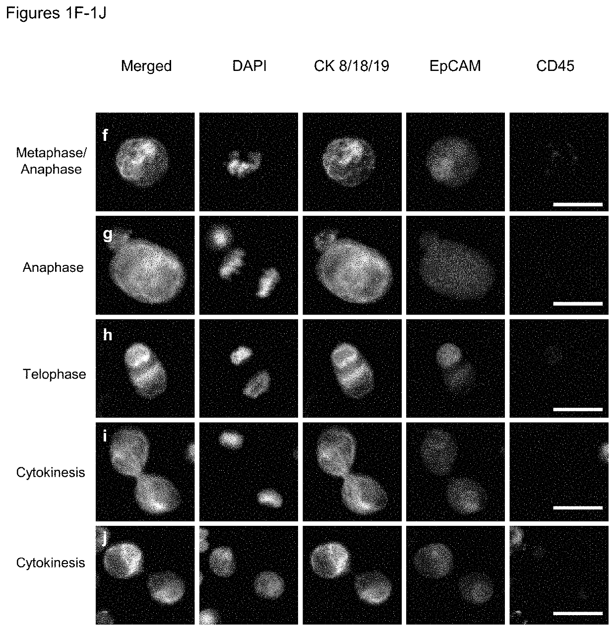 Use of circulating tumor cell mitotic index in cancer stratification and diagnostics