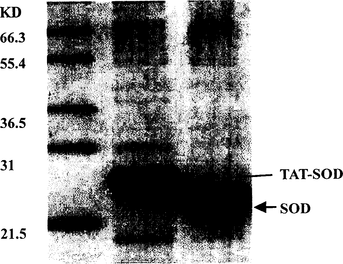 Fusion protein with protein transduction structure field TAT-PTD and application thereof