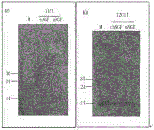 Neutralizing monoclonal antibody 12C11 of human nerve growth factor and its hybridoma cell strain