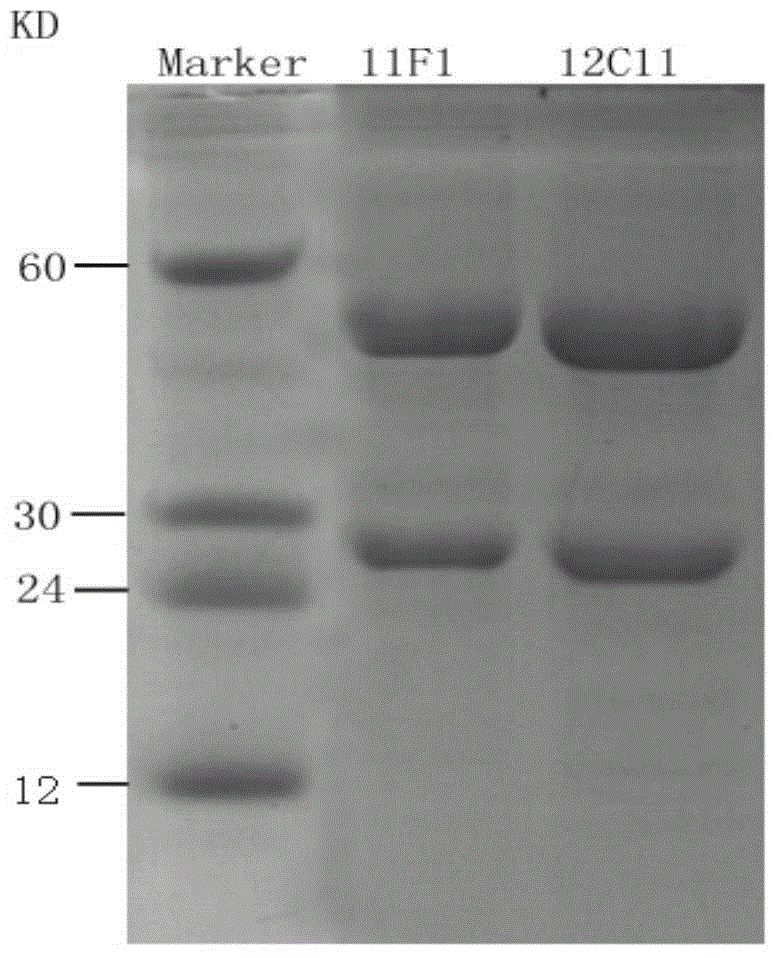 Neutralizing monoclonal antibody 12C11 of human nerve growth factor and its hybridoma cell strain