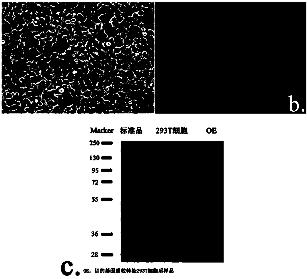 Neural stem cell preparation used for cerebral infarction treatment and bimodally traceable by magnetic resonance and fluorescence imaging