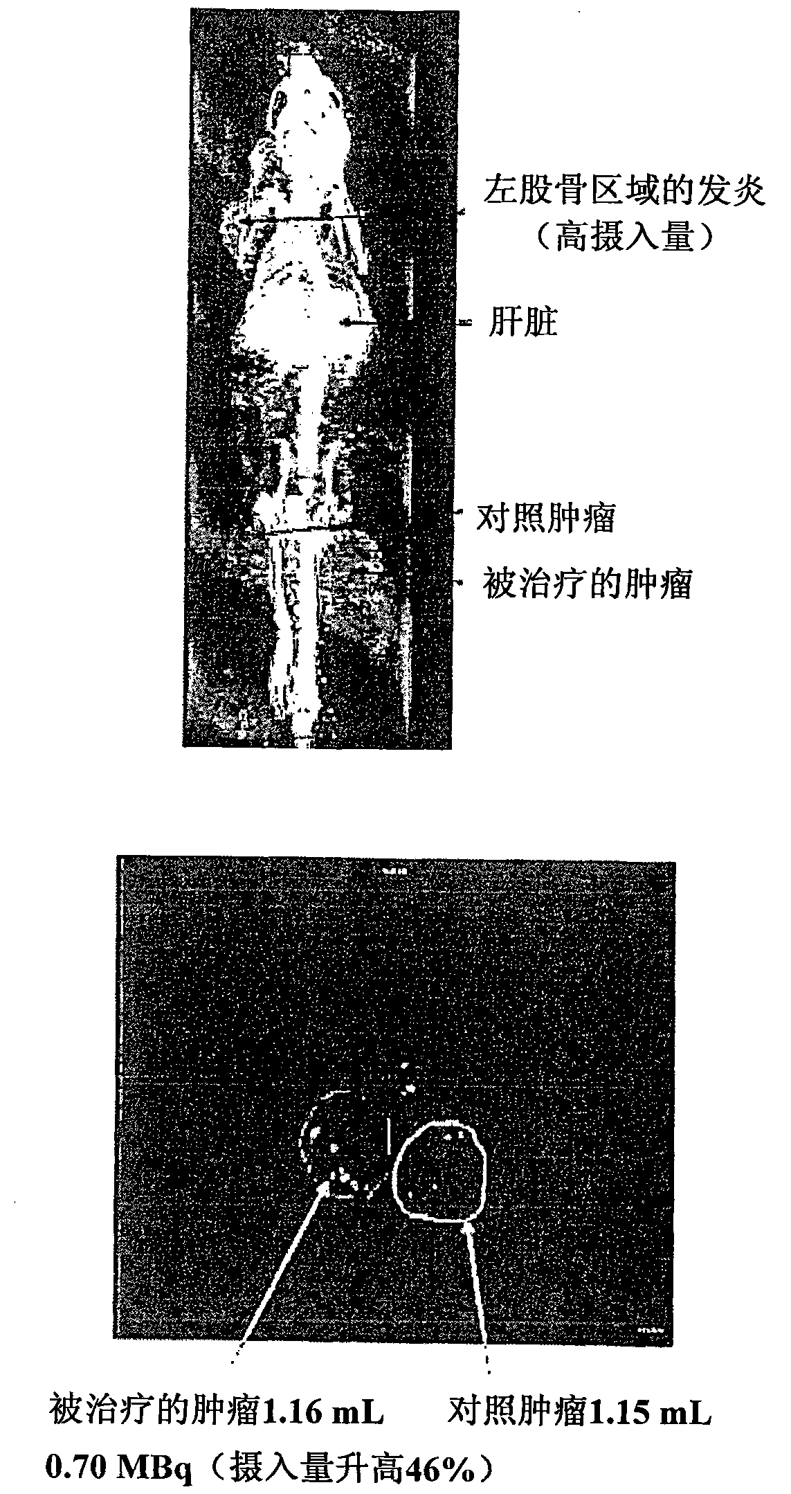 Portable radiofrequency hyperthermia device with flexible treatment electrode for electric field capacitive coupled energy transfer