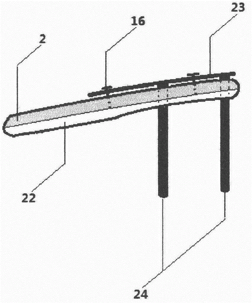 Finger traction reduction fixation splint