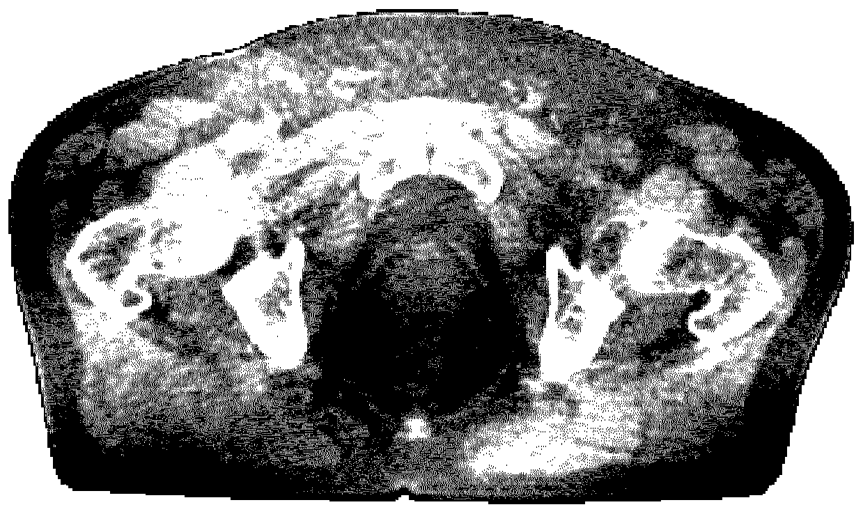 Method, computer program product and computer system for correcting CT image