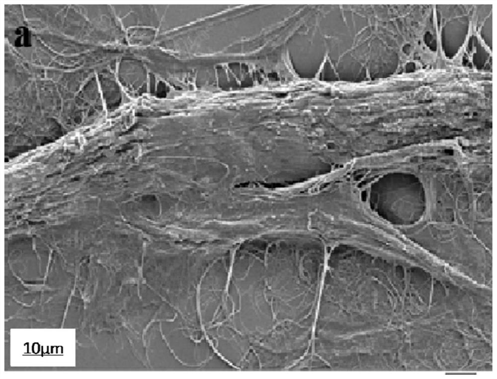 Method for preparing human dura mater repair material with simulated ECM (Extracellular Matrix) component and structure through long fiber network skeleton preforming process