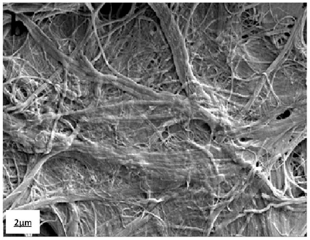 Method for preparing human dura mater repair material with simulated ECM (Extracellular Matrix) component and structure through long fiber network skeleton preforming process