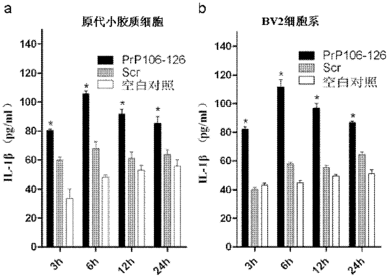 Application of NALP3-ASC inflammation complex and activator inhibitor thereof in terms of preparation of medicines for treating prion diseases