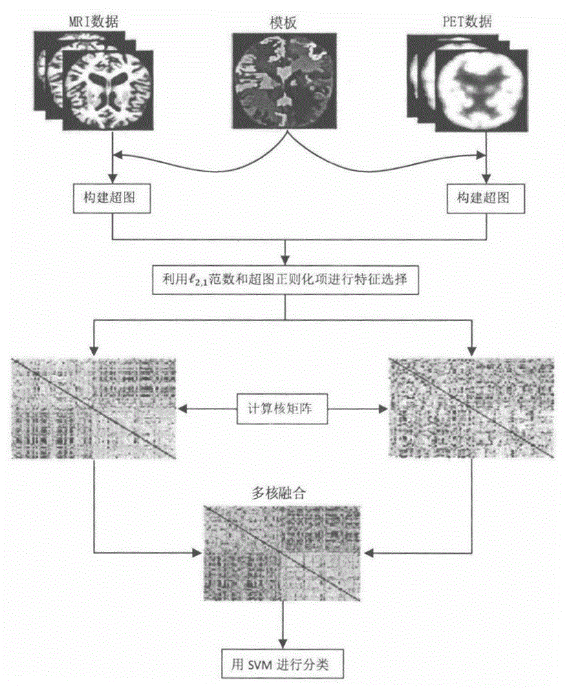 Multi-modal feature selection and classification method based on hypergraph