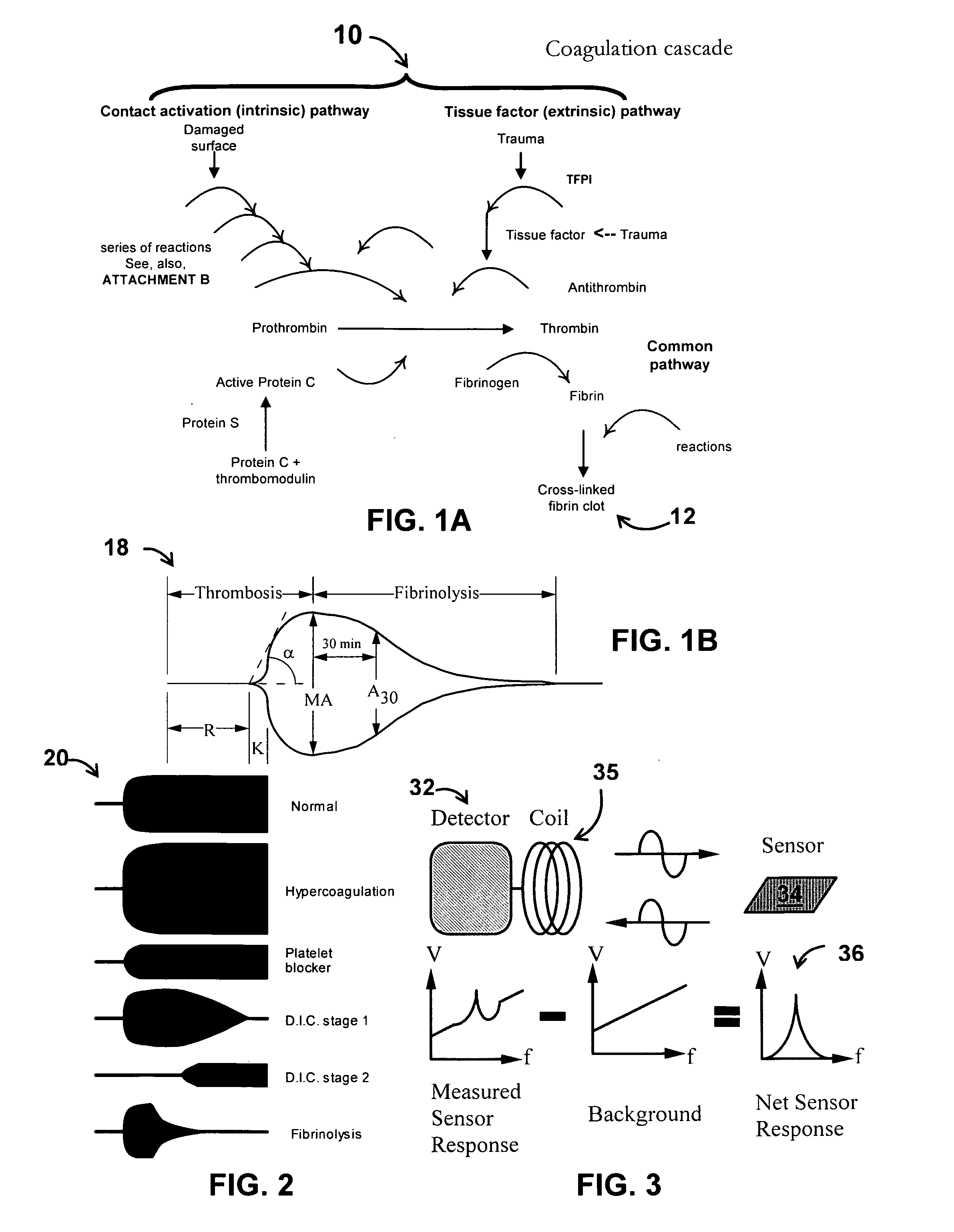 System/unit and method employing a plurality of magnetoelastic sensor elements for automatically quantifying parameters of whole blood and platelet-rich plasma