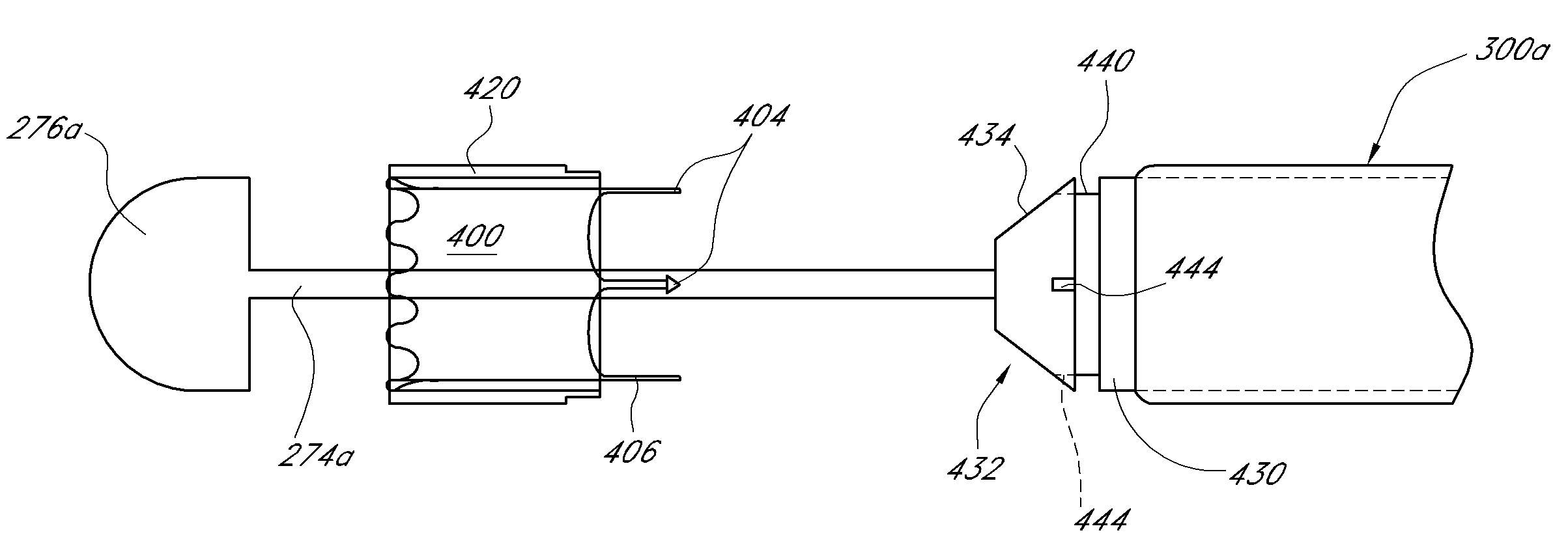 Vascular implant and delivery system