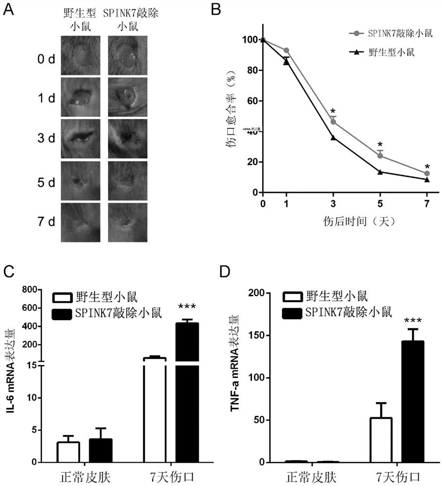 Application of protein SPINK7 in preparation of medicine for promoting healing of excessive-inflammation wounded area