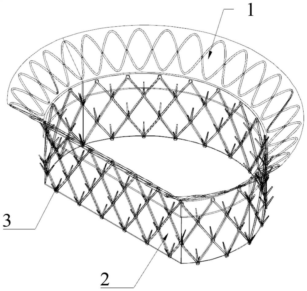 Mitral valve forming ring for intervention