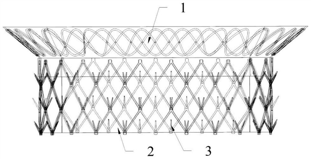 Mitral valve forming ring for intervention