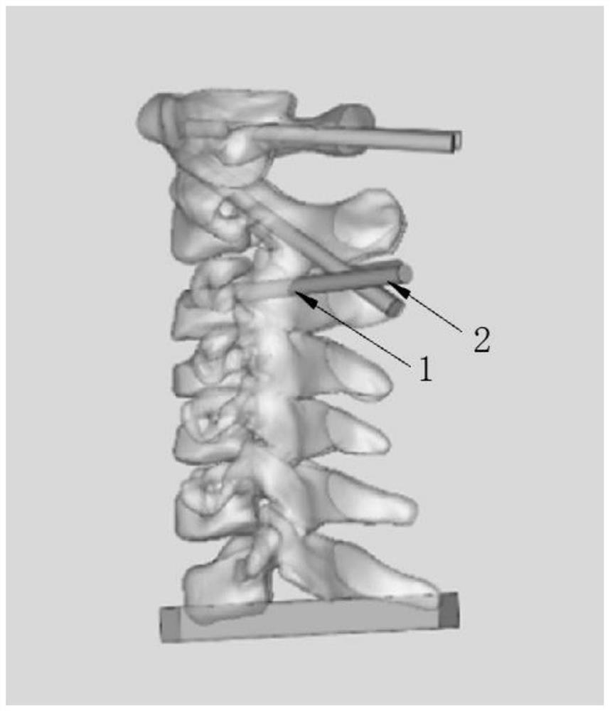 Augmented reality assisted spine internal fixation screw implantation method and system