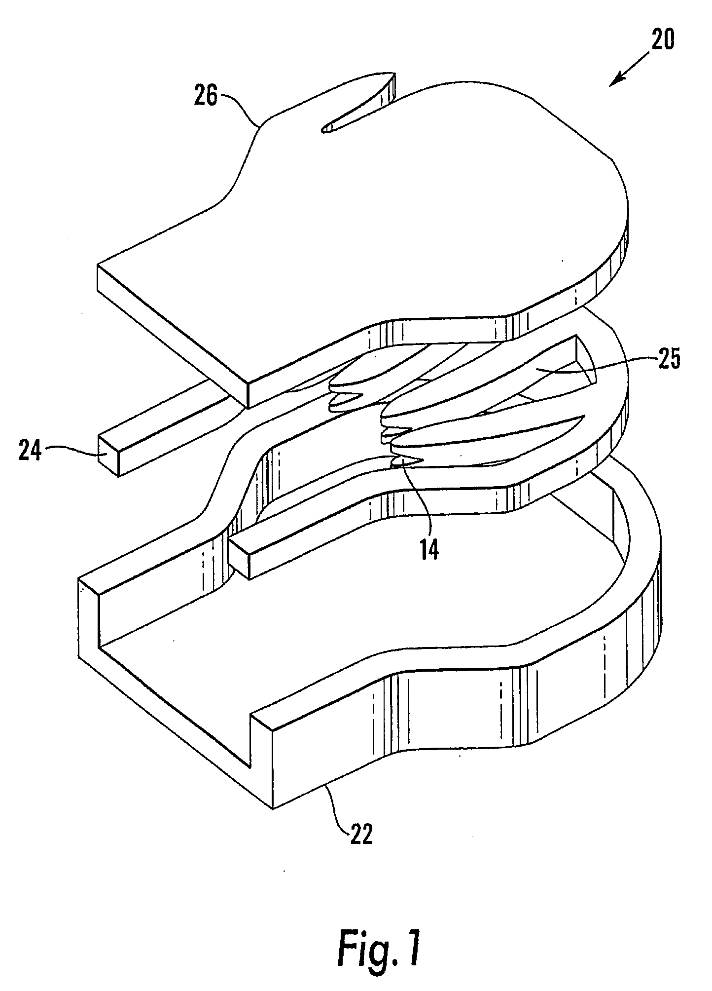 Wound treatment apparatus employing reduced pressure