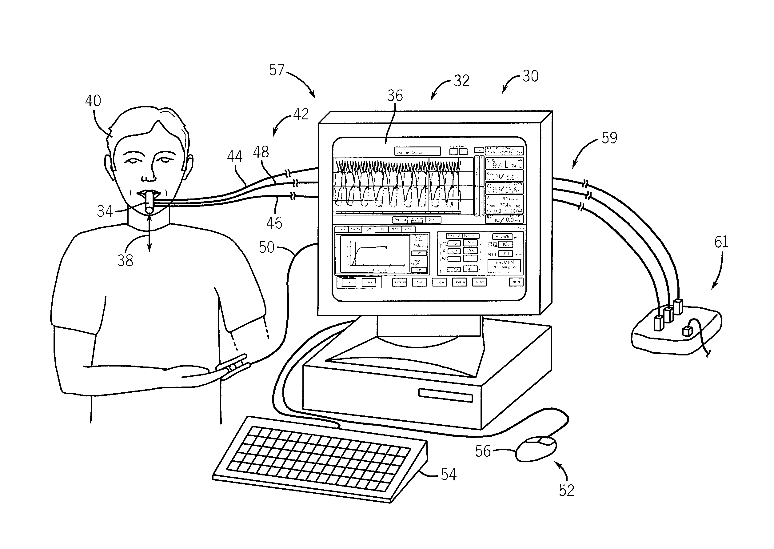 Side-stream respiratory gas monitoring system and method
