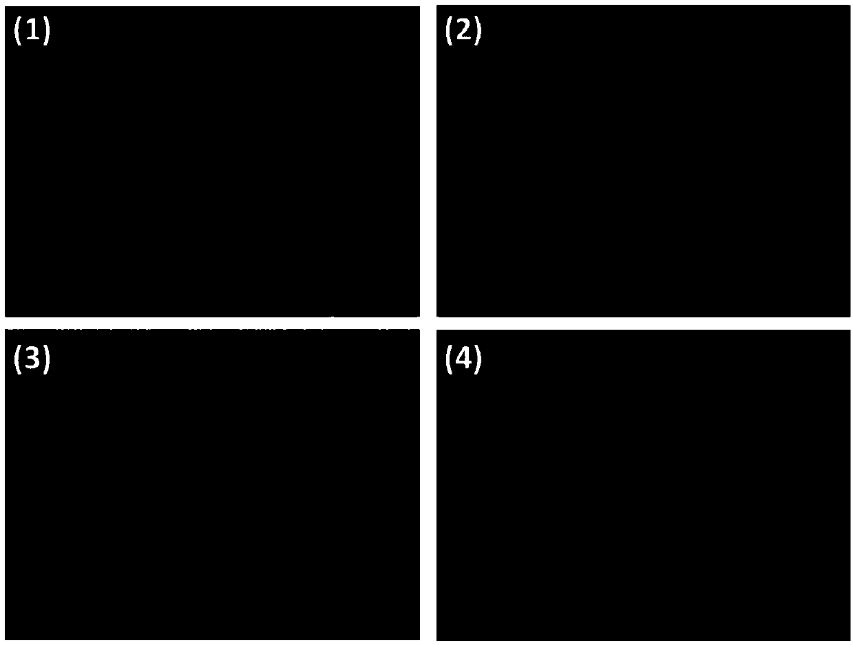 Application of specific antibody, implantable medical instrument and preparation method of implantable medical instrument